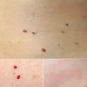 RED DOTS ON YOUR SKIN: CAUSES AND WHAT THEY MIGHT REPRESENT